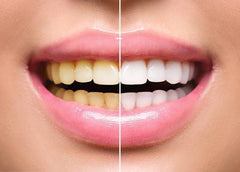 Dr. Dental Teeth Whitening Powder | 100% Natural Herbal Formula 50g